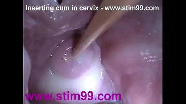 Big Insertion Semen Cum in Cervix Wide Stretching Pussy Speculum warm Videos